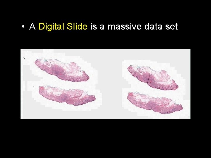  • Whole Slide Imaging A Digital Slide is a massive data set 