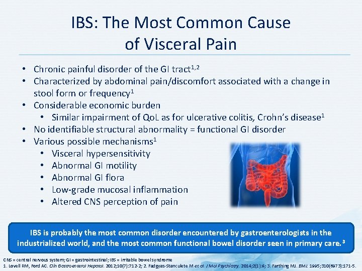 IBS: The Most Common Cause of Visceral Pain • Chronic painful disorder of the