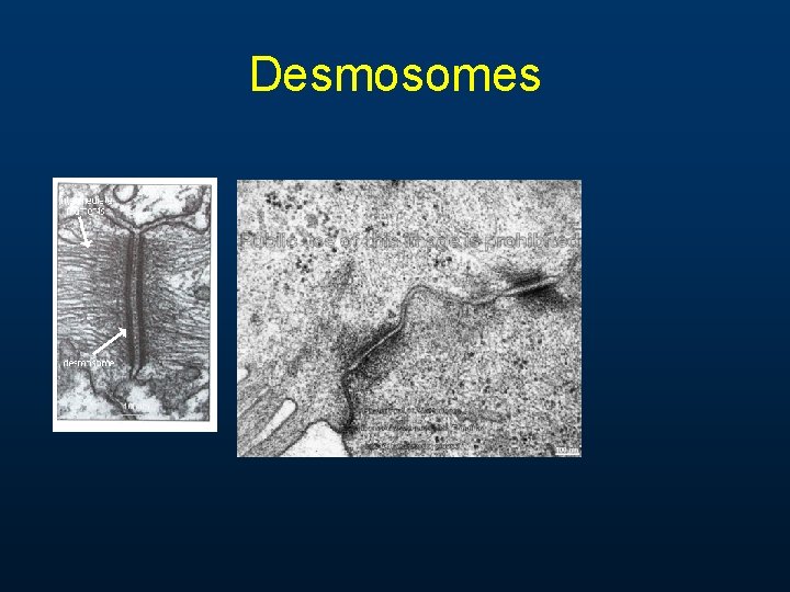 Desmosomes 