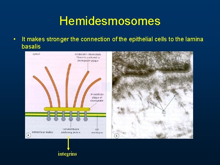 Hemidesmosomes • It makes stronger the connection of the epithelial cells to the lamina