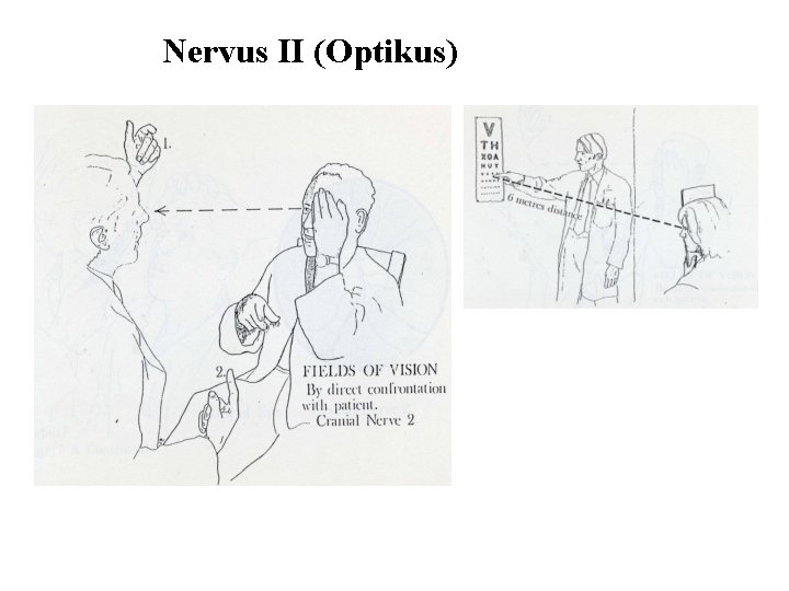 Nervus II (Optikus) 