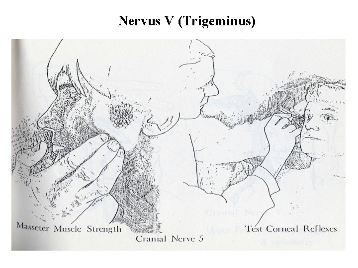 Nervus V (Trigeminus) 