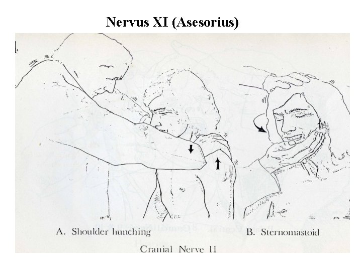 Nervus XI (Asesorius) 