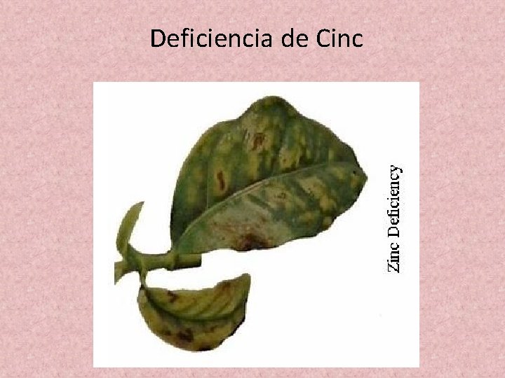 Deficiencia de Cinc Deficiencia de Cinc