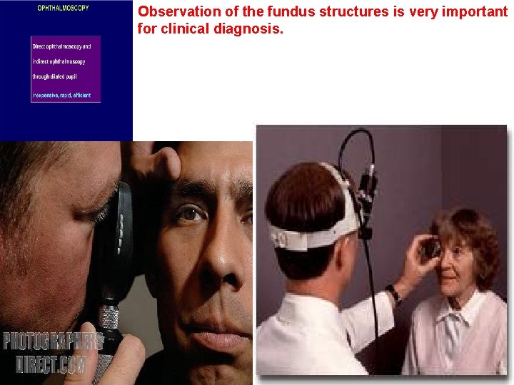 Observation of the fundus structures is very important for clinical diagnosis. 