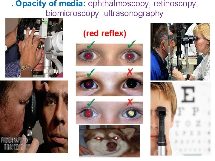 . Opacity of media: ophthalmoscopy, retinoscopy, biomicroscopy. ultrasonography (red reflex) 