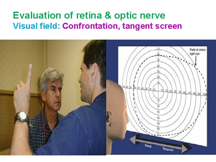 Evaluation of retina & optic nerve Visual field: Confrontation, tangent screen 