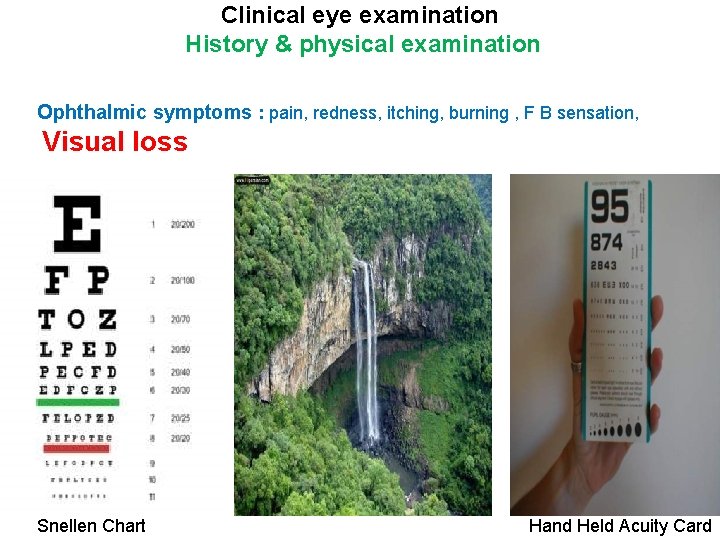 Clinical eye examination History & physical examination Ophthalmic symptoms : pain, redness, itching, burning