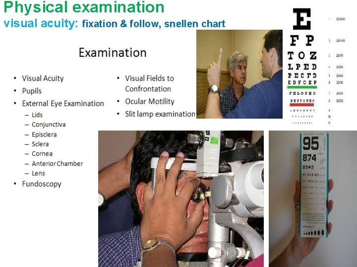 Physical examination visual acuity: fixation & follow, snellen chart 