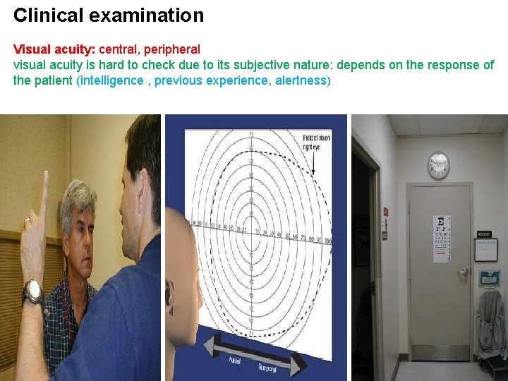 Clinical examination Visual acuity: central, peripheral visual acuity is hard to check due to