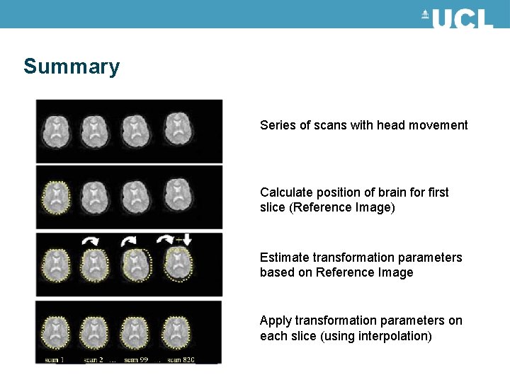 Summary Series of scans with head movement Calculate position of brain for first slice Summary Series of scans with head movement Calculate position of brain for first slice