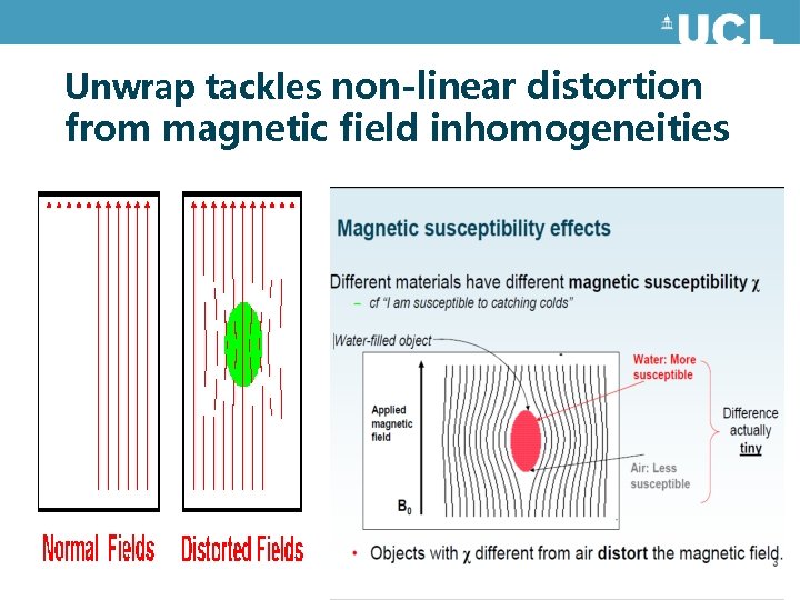 Unwrap tackles non-linear distortion from magnetic field inhomogeneities Unwrap tackles non-linear distortion from magnetic field inhomogeneities