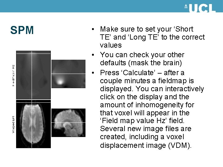 SPM • Make sure to set your ‘Short TE’ and ‘Long TE’ to the SPM • Make sure to set your ‘Short TE’ and ‘Long TE’ to the