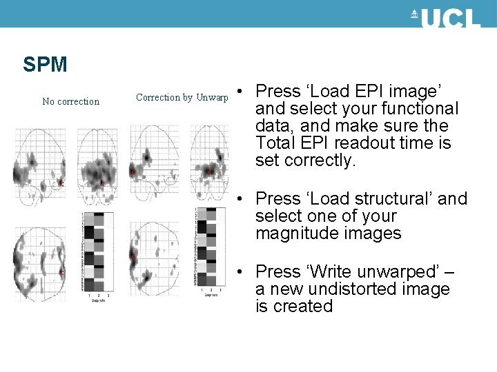 SPM No correction Correction by Unwarp • Press ‘Load EPI image’ and select your SPM No correction Correction by Unwarp • Press ‘Load EPI image’ and select your