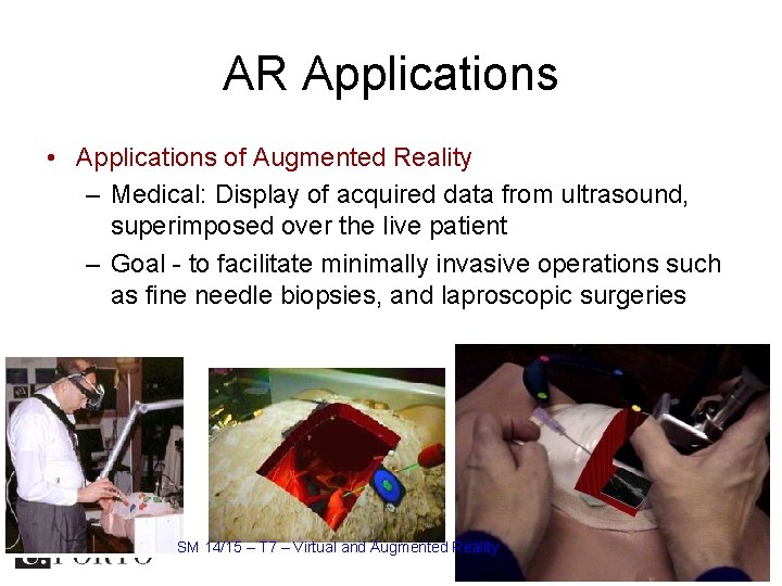 AR Applications • Applications of Augmented Reality – Medical: Display of acquired data from