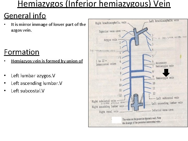 Hemiazygos (Inferior hemiazygous) Vein General info • It is mirror immage of lower part
