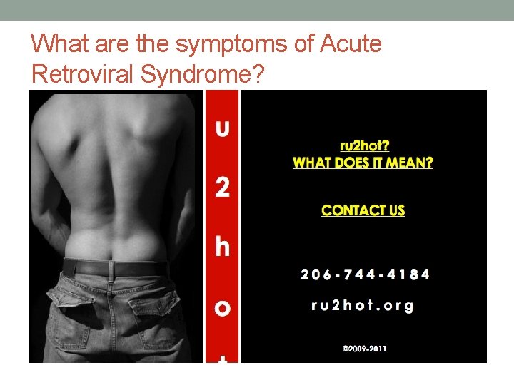 What are the symptoms of Acute Retroviral Syndrome? 