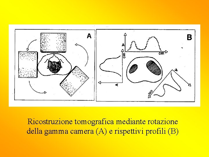 Ricostruzione tomografica mediante rotazione della gamma camera (A) e rispettivi profili (B) 