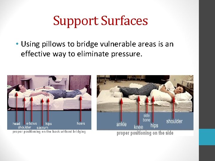 Support Surfaces • Using pillows to bridge vulnerable areas is an effective way to