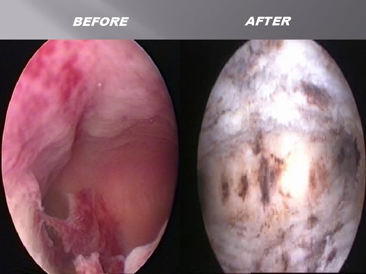 BEFORE AFTER BEFORE AFTER