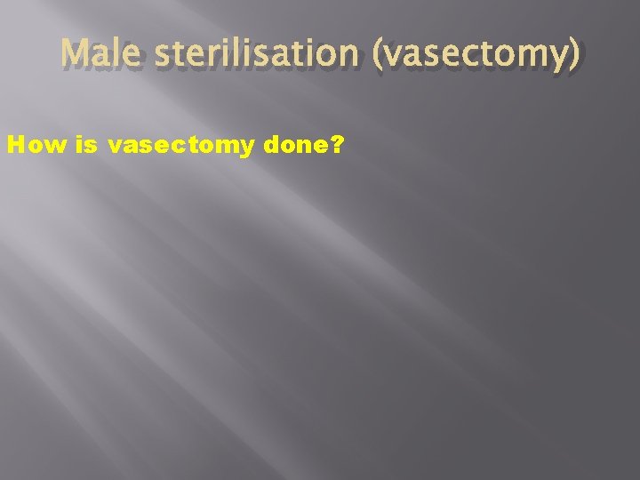 Male sterilisation (vasectomy) How is vasectomy done? Male sterilisation (vasectomy) How is vasectomy done?
