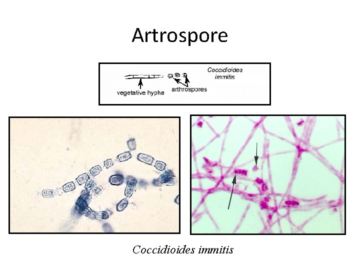 Artrospore Coccidioides immitis Artrospore Coccidioides immitis