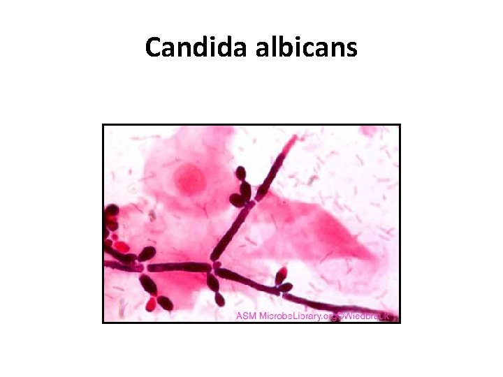 Candida albicans Candida albicans