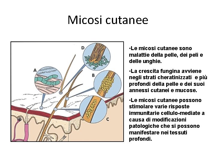 Micosi cutanee • Le micosi cutanee sono malattie della pelle, dei peli e delle Micosi cutanee • Le micosi cutanee sono malattie della pelle, dei peli e delle