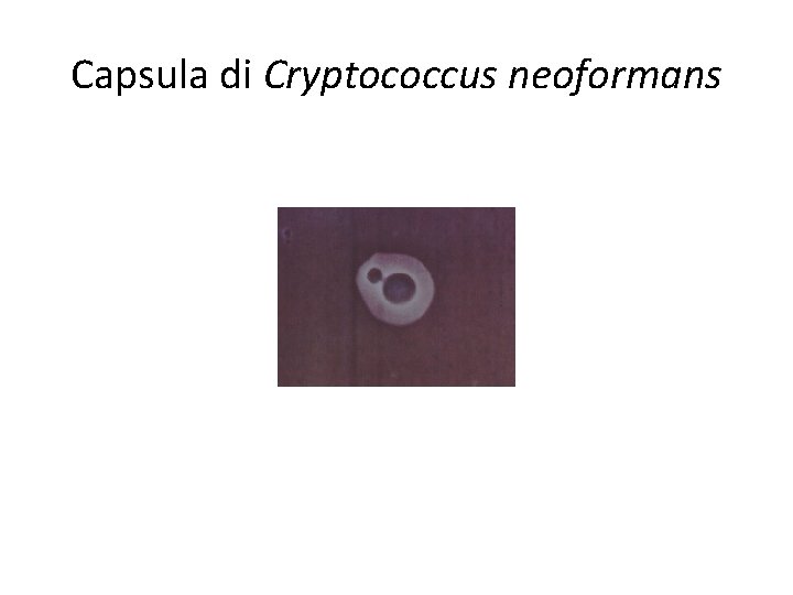 Capsula di Cryptococcus neoformans Capsula di Cryptococcus neoformans