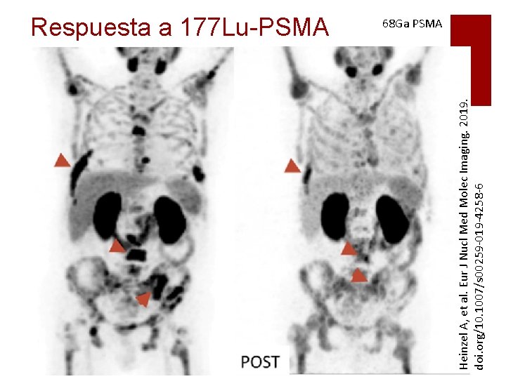 Heinzel A, et al. Eur J Nucl Med Molec Imaging. 2019. doi. org/10. 1007/s Heinzel A, et al. Eur J Nucl Med Molec Imaging. 2019. doi. org/10. 1007/s