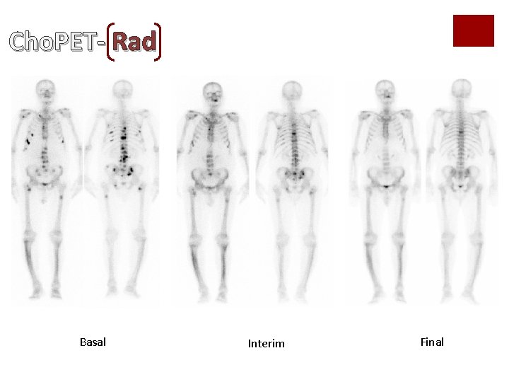 Cho. PET- Rad Basal Interim Final Cho. PET- Rad Basal Interim Final