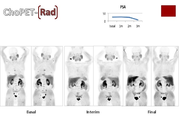 Cho. PET- Rad Basal Interim Final Cho. PET- Rad Basal Interim Final