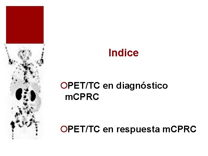 Indice ¡PET/TC en diagnóstico m. CPRC ¡PET/TC en respuesta m. CPRC Indice ¡PET/TC en diagnóstico m. CPRC ¡PET/TC en respuesta m. CPRC