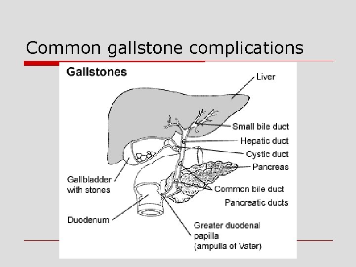 Common gallstone complications 