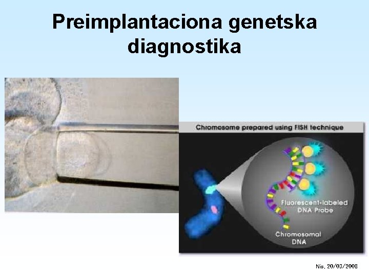 Preimplantaciona genetska diagnostika Nis, 20/03/2008 