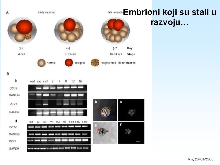 Embrioni koji su stali u razvoju… Nis, 20/03/2008 