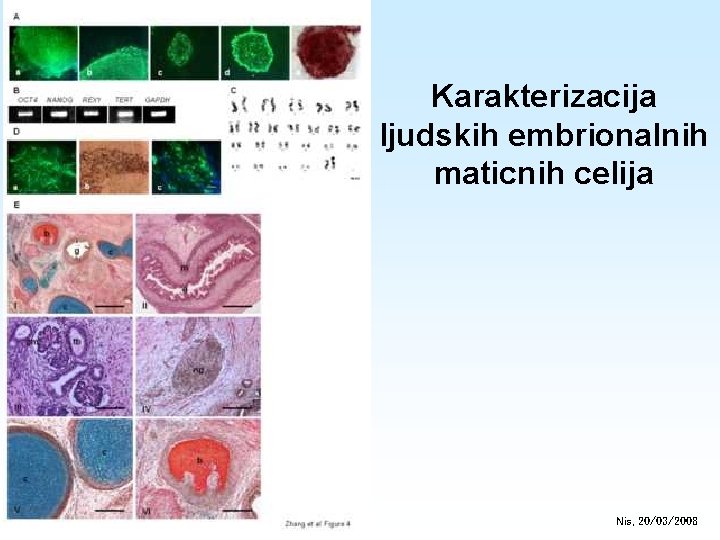 Karakterizacija ljudskih embrionalnih maticnih celija Nis, 20/03/2008 