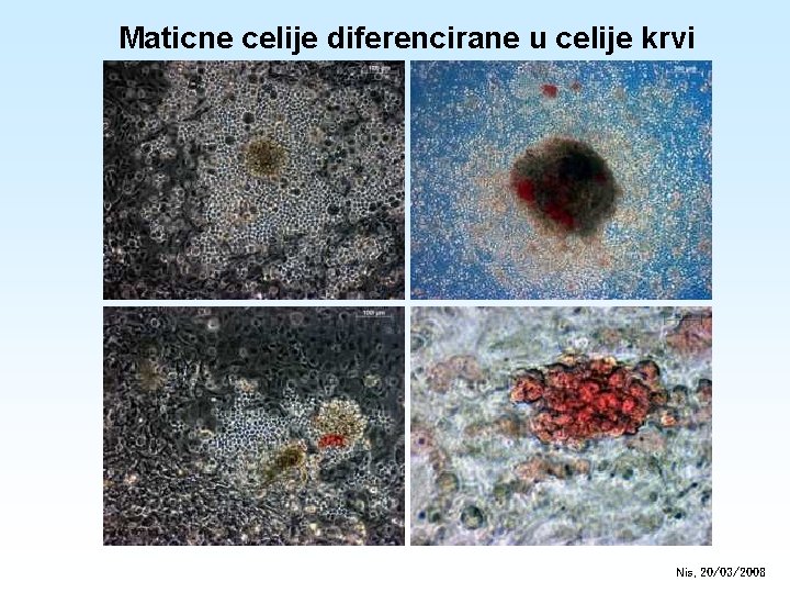 Maticne celije diferencirane u celije krvi Nis, 20/03/2008 