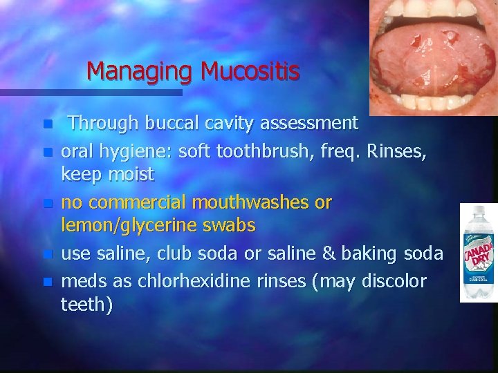 Managing Mucositis n n n Through buccal cavity assessment oral hygiene: soft toothbrush, freq.