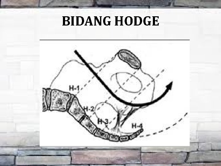 BIDANG HODGE Rury Narulita Sari, SST. , M. Kes 10 