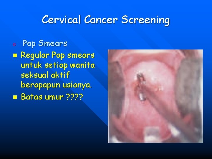 Cervical Cancer Screening o n n Pap Smears Regular Pap smears untuk setiap wanita