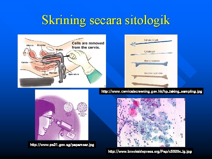 Skrining secara sitologik http: //www. cervicalscreening. gov. hk/hp_taking_sampling. jpg http: //www. ps 21. gov.