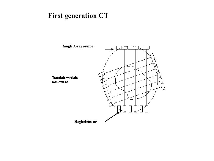 First generation CT Single X-ray source Translate – rotate movement Single detector 