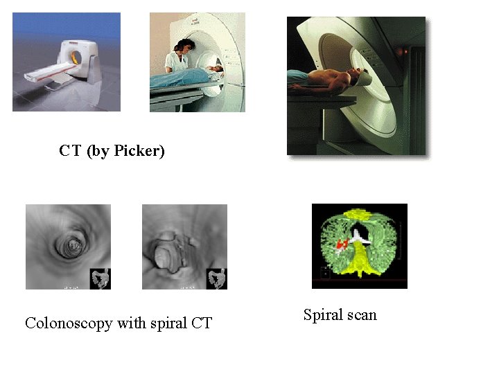 CT (by Picker) Colonoscopy with spiral CT Spiral scan 