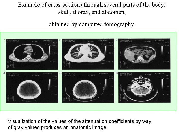 Example of cross-sections through several parts of the body: skull, thorax, and abdomen, obtained