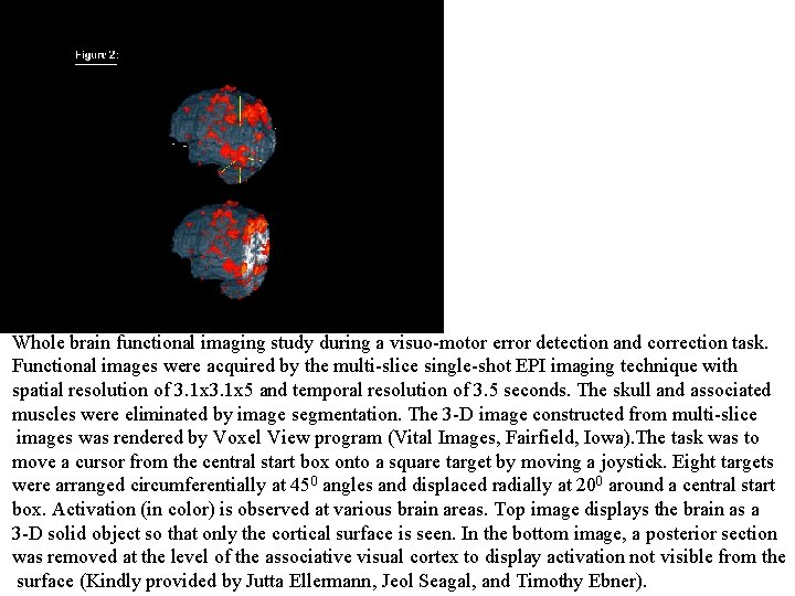 Whole brain functional imaging study during a visuo-motor error detection and correction task. Functional