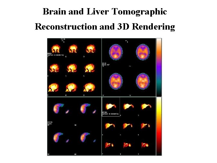 Brain and Liver Tomographic Reconstruction and 3 D Rendering 
