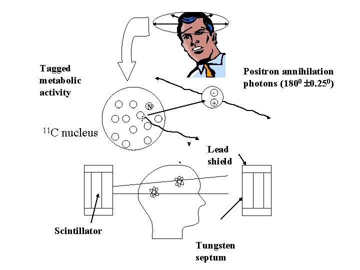 Tagged metabolic activity Positron annihilation photons (1800 0. 250) + N PP 11 C