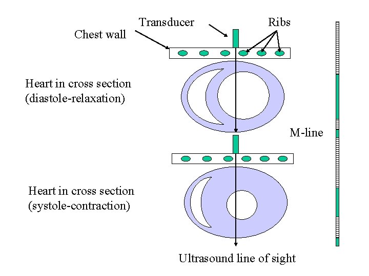 Chest wall Transducer Ribs Heart in cross section (diastole-relaxation) M-line Heart in cross section