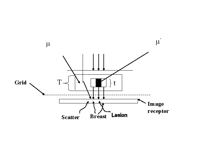  ’ Grid T Scatter t Breast Lesion Image receptor 